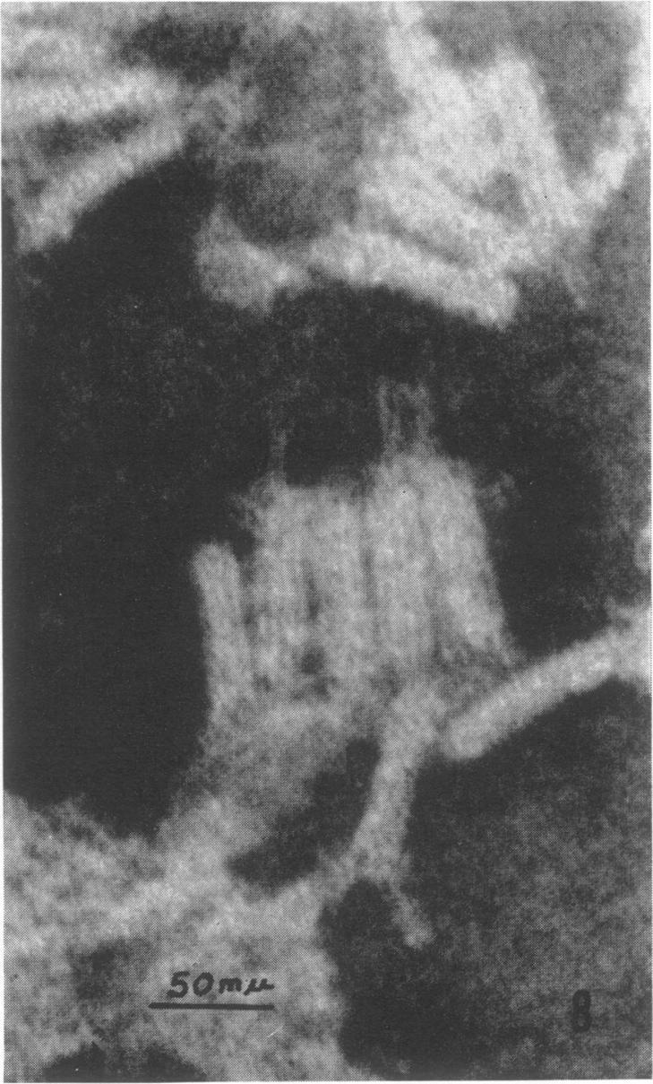 https://cdn.ncbi.nlm.nih.gov/pmc/blobs/75df/375761/3f24c06635da/jvirol00302-0174-d.jpg