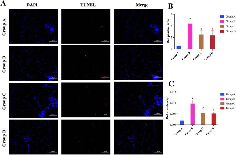 https://cdn.ncbi.nlm.nih.gov/pmc/blobs/75e0/11417114/807a33c25ca4/JIR-17-6501-g0005.jpg