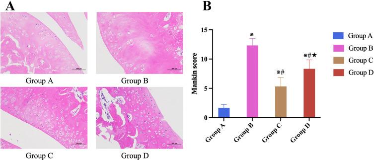 https://cdn.ncbi.nlm.nih.gov/pmc/blobs/75e0/11417114/c8eece3e2fcf/JIR-17-6501-g0004.jpg