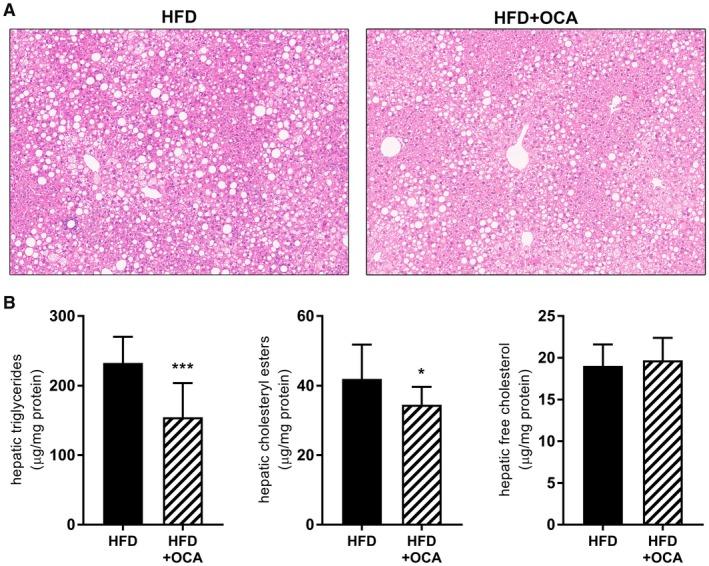 https://cdn.ncbi.nlm.nih.gov/pmc/blobs/75e1/6287481/f72ca12295c2/HEP4-2-1513-g004.jpg