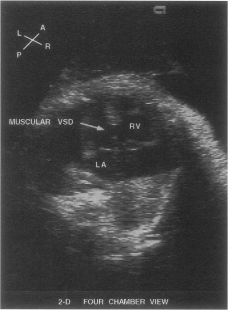 https://cdn.ncbi.nlm.nih.gov/pmc/blobs/75e6/325466/87be770f9f10/thij00027-0022-a.jpg