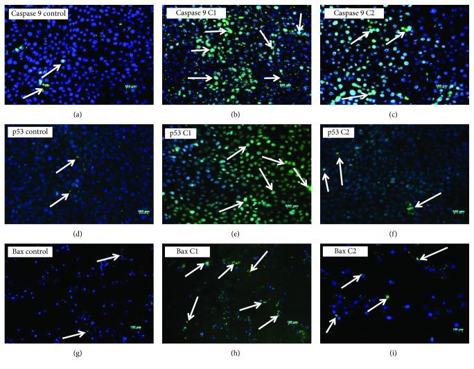 https://cdn.ncbi.nlm.nih.gov/pmc/blobs/75eb/6589211/3f239e1a7cc3/OMCL2019-6797921.009.jpg