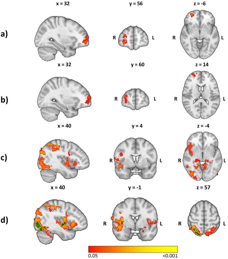https://cdn.ncbi.nlm.nih.gov/pmc/blobs/75ee/9226020/57397af4ae50/41598_2022_14659_Fig3_HTML.jpg