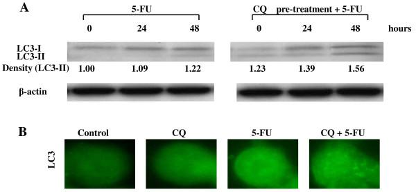 https://cdn.ncbi.nlm.nih.gov/pmc/blobs/75f5/2914703/d1542202db05/1471-2407-10-370-4.jpg