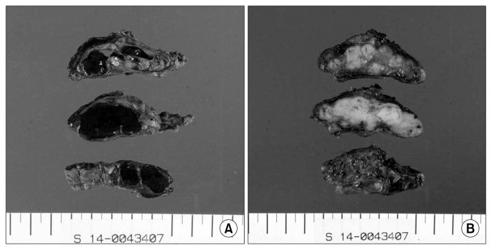 https://cdn.ncbi.nlm.nih.gov/pmc/blobs/75fc/5295489/9dc305fce98e/kjtcvs-50-068f2.jpg