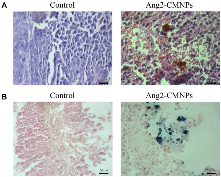 https://cdn.ncbi.nlm.nih.gov/pmc/blobs/75ff/7455758/832060787210/CMAR-12-7475-g0002.jpg