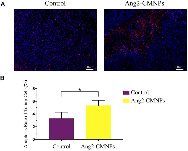 https://cdn.ncbi.nlm.nih.gov/pmc/blobs/75ff/7455758/dfa8ac5753cc/CMAR-12-7475-g0005.jpg