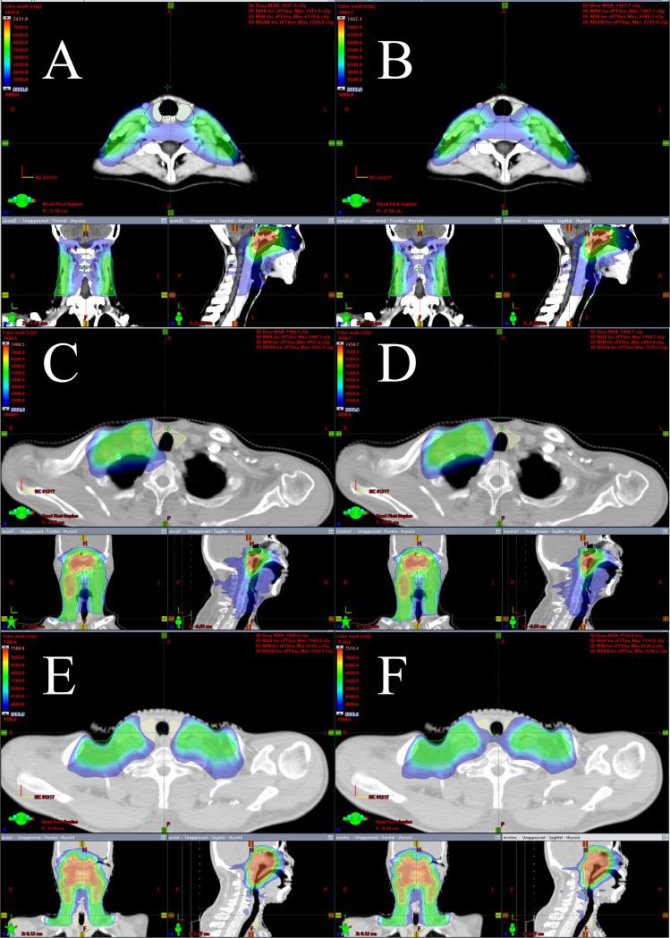 https://cdn.ncbi.nlm.nih.gov/pmc/blobs/7601/12198196/2705696a060d/fonc-15-1443226-g001.jpg