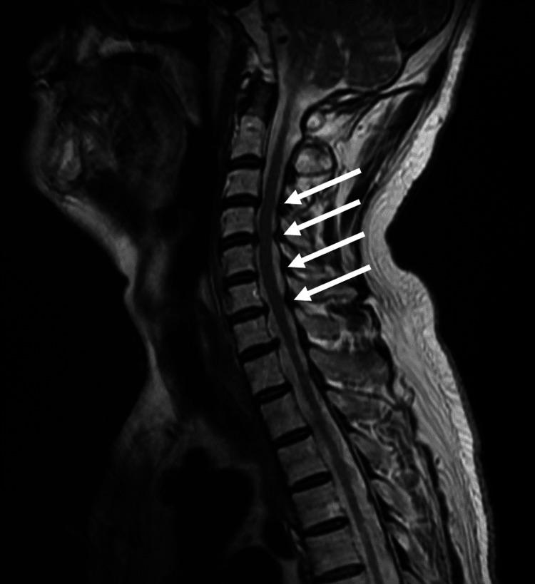 https://cdn.ncbi.nlm.nih.gov/pmc/blobs/7609/11574571/f6a0495e7b35/cureus-0016-00000071904-i02.jpg