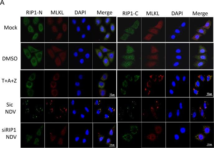 https://cdn.ncbi.nlm.nih.gov/pmc/blobs/760b/5522139/6b7a9ae7c16c/oncotarget-08-43201-g008a.jpg