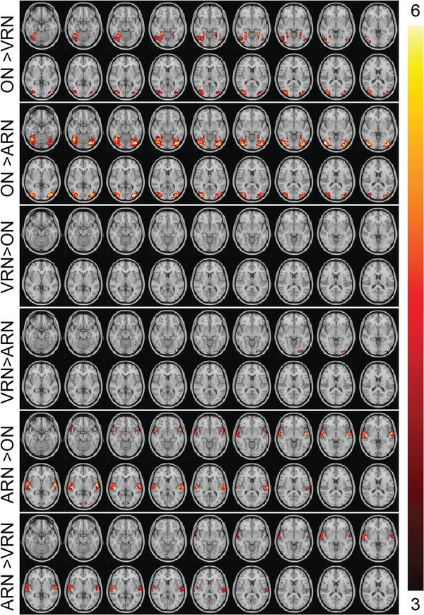 https://cdn.ncbi.nlm.nih.gov/pmc/blobs/7614/9226851/69074e434945/BRB3-12-e2609-g001.jpg