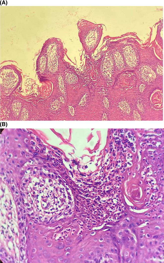 https://cdn.ncbi.nlm.nih.gov/pmc/blobs/7616/9913193/aacb11ac33d4/CCR3-11-e6929-g001.jpg
