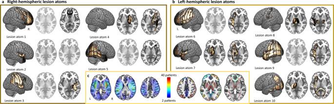 https://cdn.ncbi.nlm.nih.gov/pmc/blobs/761d/8172535/7672459a5a2a/41467_2021_23492_Fig1_HTML.jpg