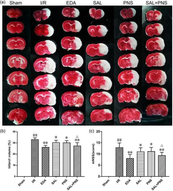 https://cdn.ncbi.nlm.nih.gov/pmc/blobs/7620/11410882/1a563c36d794/BRB3-14-e70036-g009.jpg