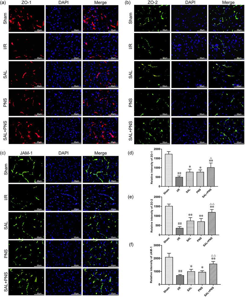 https://cdn.ncbi.nlm.nih.gov/pmc/blobs/7620/11410882/3e71aa474424/BRB3-14-e70036-g003.jpg