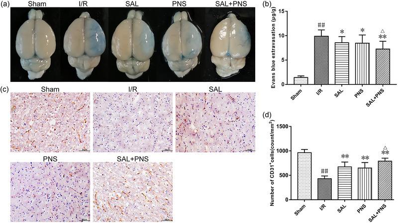 https://cdn.ncbi.nlm.nih.gov/pmc/blobs/7620/11410882/484f75a43969/BRB3-14-e70036-g010.jpg