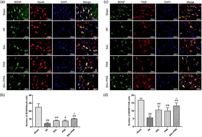 https://cdn.ncbi.nlm.nih.gov/pmc/blobs/7620/11410882/68ba27c66301/BRB3-14-e70036-g002.jpg