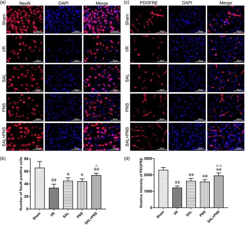 https://cdn.ncbi.nlm.nih.gov/pmc/blobs/7620/11410882/6c91473170cc/BRB3-14-e70036-g005.jpg