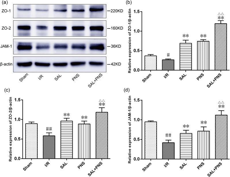https://cdn.ncbi.nlm.nih.gov/pmc/blobs/7620/11410882/9be35658516f/BRB3-14-e70036-g006.jpg