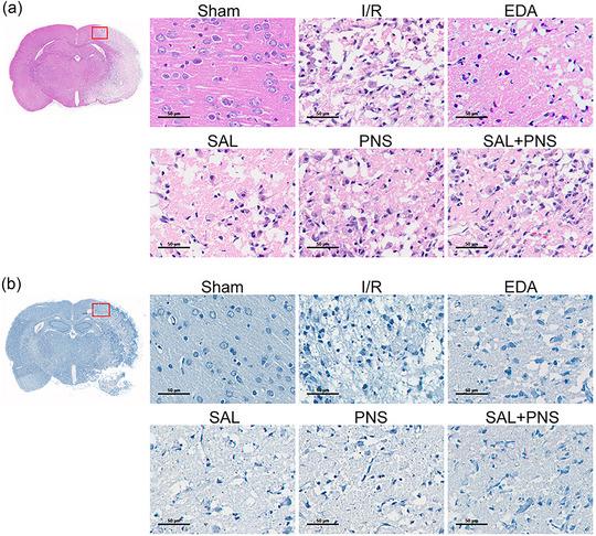 https://cdn.ncbi.nlm.nih.gov/pmc/blobs/7620/11410882/aaa987a670c9/BRB3-14-e70036-g011.jpg