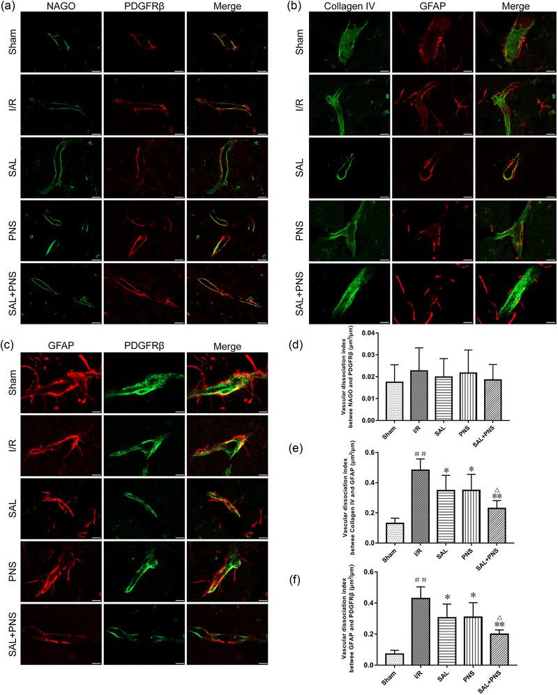 https://cdn.ncbi.nlm.nih.gov/pmc/blobs/7620/11410882/eb9440265e6d/BRB3-14-e70036-g008.jpg