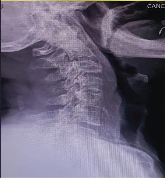 https://cdn.ncbi.nlm.nih.gov/pmc/blobs/7627/7792880/12b281c3061e/ABR-9-47-g003.jpg