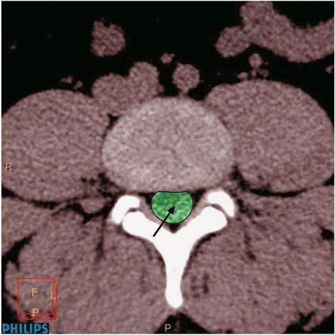 https://cdn.ncbi.nlm.nih.gov/pmc/blobs/7629/5057209/84ef73b4b6b9/12891_2016_1282_Fig1_HTML.jpg