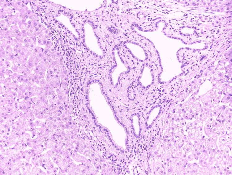 https://cdn.ncbi.nlm.nih.gov/pmc/blobs/762a/9236677/6b3e8d718b79/cureus-0014-00000025361-i03.jpg