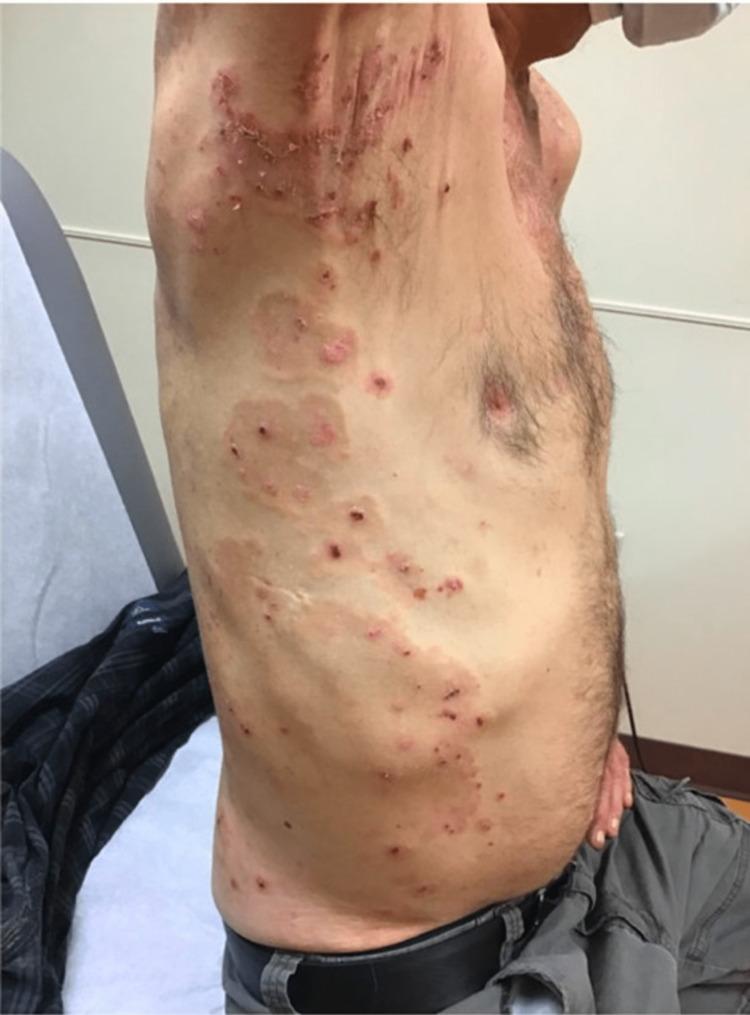 https://cdn.ncbi.nlm.nih.gov/pmc/blobs/762b/10491457/ceea96f9371a/cureus-0015-00000043230-i01.jpg