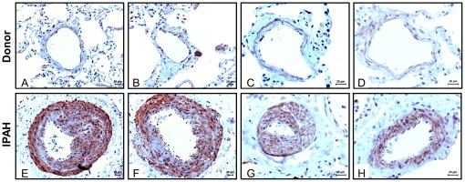 https://cdn.ncbi.nlm.nih.gov/pmc/blobs/7639/3073929/5a212a209e8b/pone.0018136.g009.jpg