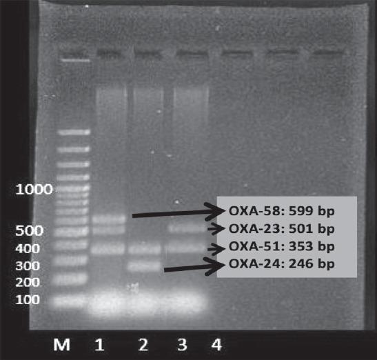 https://cdn.ncbi.nlm.nih.gov/pmc/blobs/763b/6194996/b9547333d778/SaudiMedJ-39-767-g003.jpg
