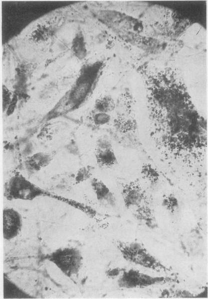 https://cdn.ncbi.nlm.nih.gov/pmc/blobs/763f/1030850/56b3182175fc/annrheumd00210-0065-b.jpg