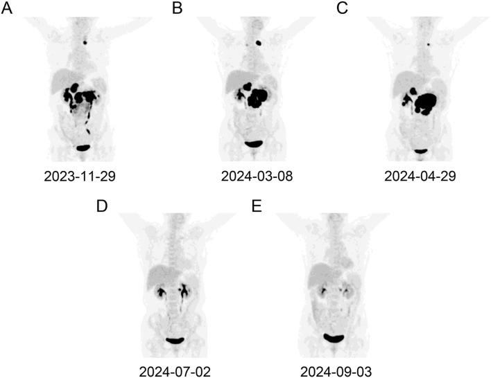 https://cdn.ncbi.nlm.nih.gov/pmc/blobs/7642/11994609/ac837a5f6dd0/fimmu-16-1566035-g001.jpg