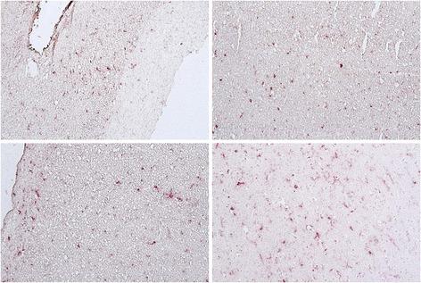 https://cdn.ncbi.nlm.nih.gov/pmc/blobs/7644/4385031/4fccf47c9f7c/40169_2015_49_Fig2_HTML.jpg
