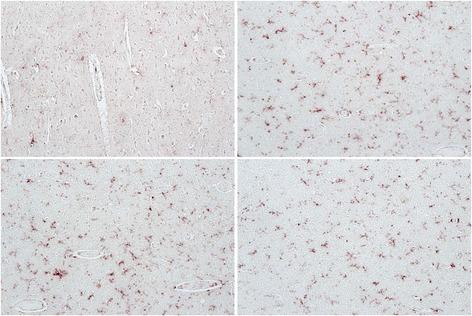 https://cdn.ncbi.nlm.nih.gov/pmc/blobs/7644/4385031/c8ed7865275a/40169_2015_49_Fig3_HTML.jpg