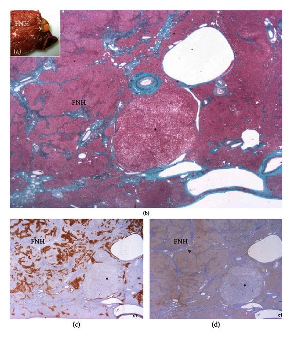 https://cdn.ncbi.nlm.nih.gov/pmc/blobs/764b/3652210/742c10887269/IJHEP2013-253261.005.jpg