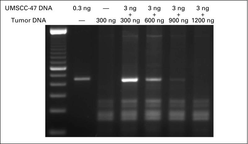 https://cdn.ncbi.nlm.nih.gov/pmc/blobs/764c/7010445/edff15425acb/JGO.18.00058app4.jpg