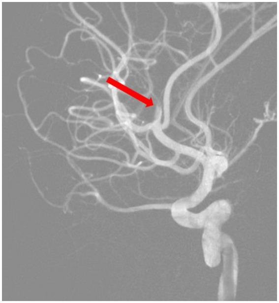 https://cdn.ncbi.nlm.nih.gov/pmc/blobs/764e/12021898/dc8cacccb8c1/fmed-12-1530420-g003.jpg