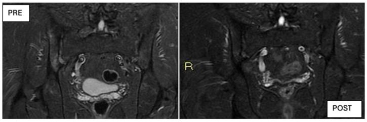 https://cdn.ncbi.nlm.nih.gov/pmc/blobs/7650/12072272/571c514c6dc2/jcm-14-03151-g009.jpg