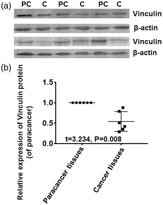 https://cdn.ncbi.nlm.nih.gov/pmc/blobs/7656/7140223/1238c2b1e2b2/10.1177_0300060519839523-fig2.jpg