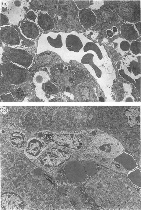 https://cdn.ncbi.nlm.nih.gov/pmc/blobs/7657/1421651/c530d1c185fe/immunology00103-0084-a.jpg