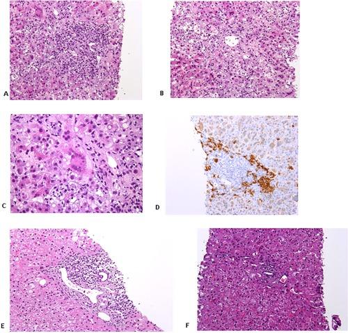 https://cdn.ncbi.nlm.nih.gov/pmc/blobs/7657/5721398/3a942a406cc9/HEP4-1-293-g001.jpg