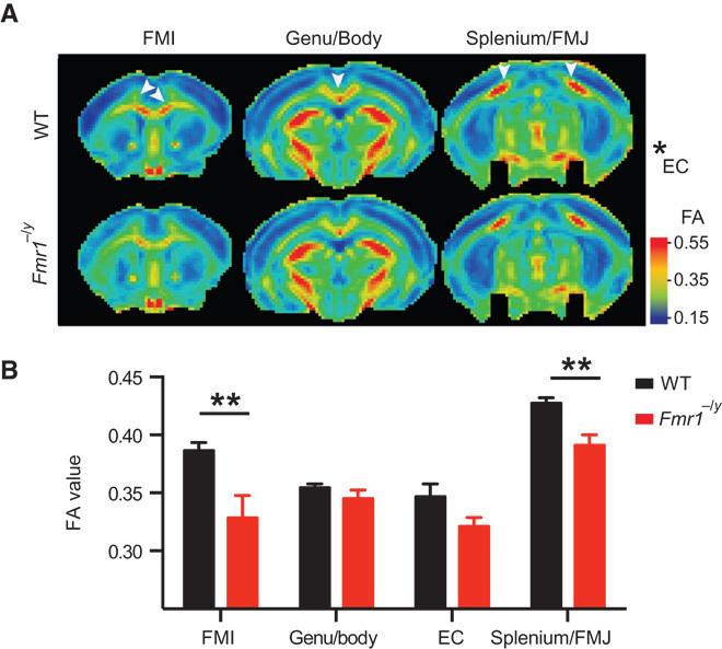https://cdn.ncbi.nlm.nih.gov/pmc/blobs/7659/4681325/cd22e93e2bdc/1500775-F1.jpg