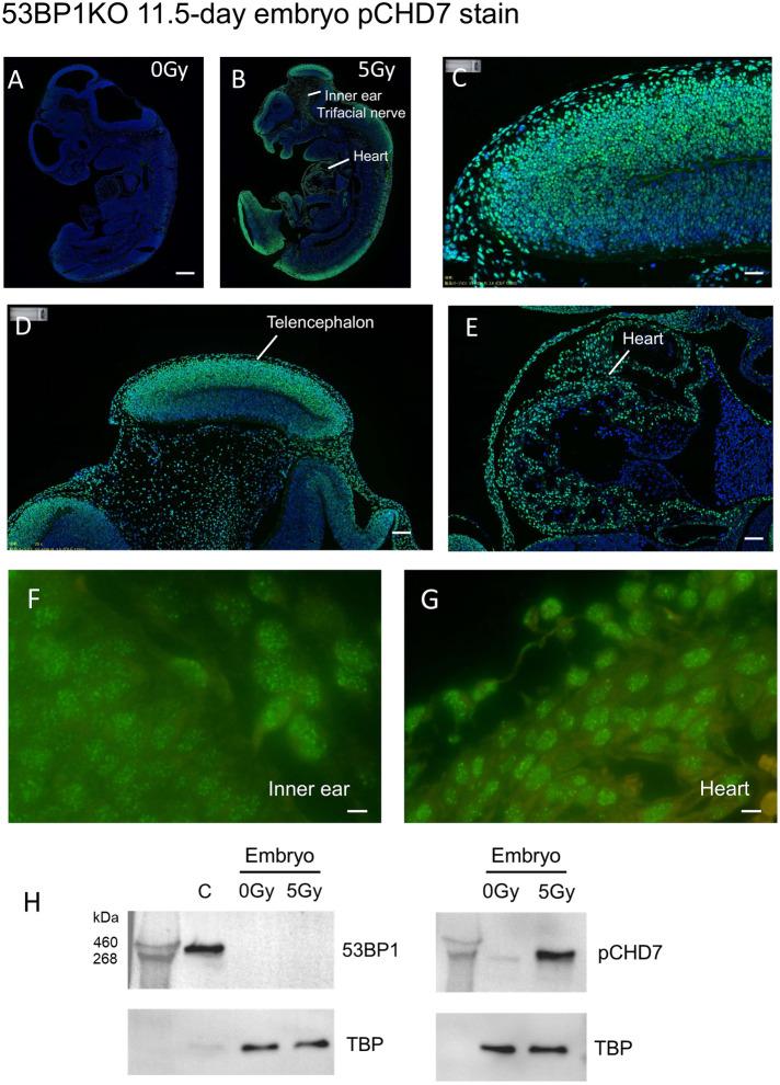 https://cdn.ncbi.nlm.nih.gov/pmc/blobs/765b/10162424/18185cdbd012/mbc-34-ar39-g004.jpg