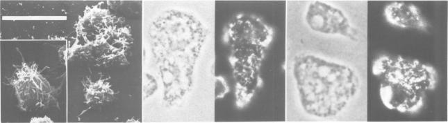 https://cdn.ncbi.nlm.nih.gov/pmc/blobs/7668/453159/8b14eb0af174/emboj00111-0117-a.jpg
