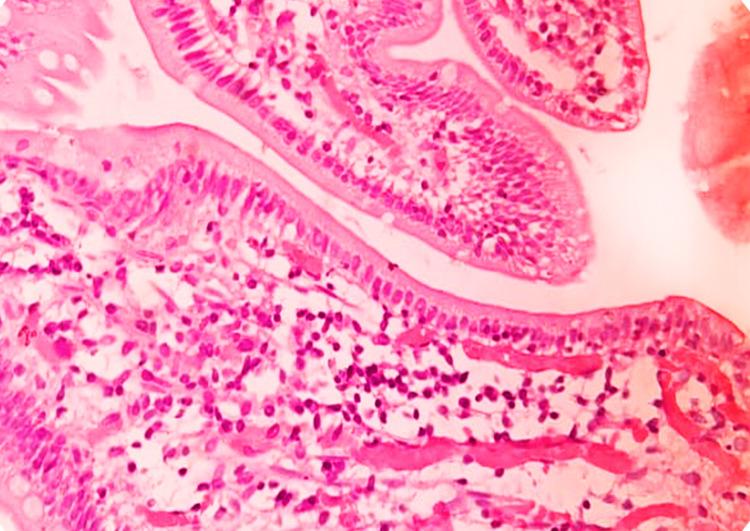 https://cdn.ncbi.nlm.nih.gov/pmc/blobs/766d/10122749/85de0b52f880/cureus-0015-00000036619-i01.jpg