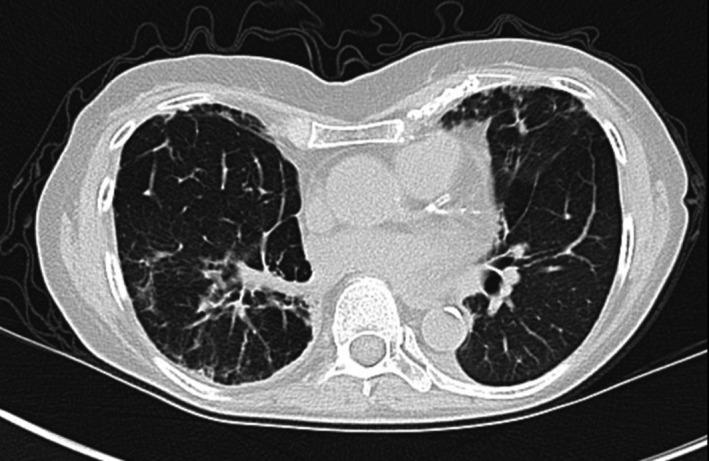 https://cdn.ncbi.nlm.nih.gov/pmc/blobs/766e/8145267/fa52d81b0eeb/CCR3-9-e03164-g001.jpg