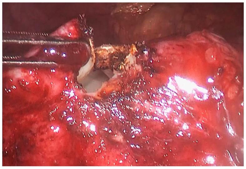 https://cdn.ncbi.nlm.nih.gov/pmc/blobs/7671/6956320/27d3c0dbd281/medicina-55-00771-g002.jpg