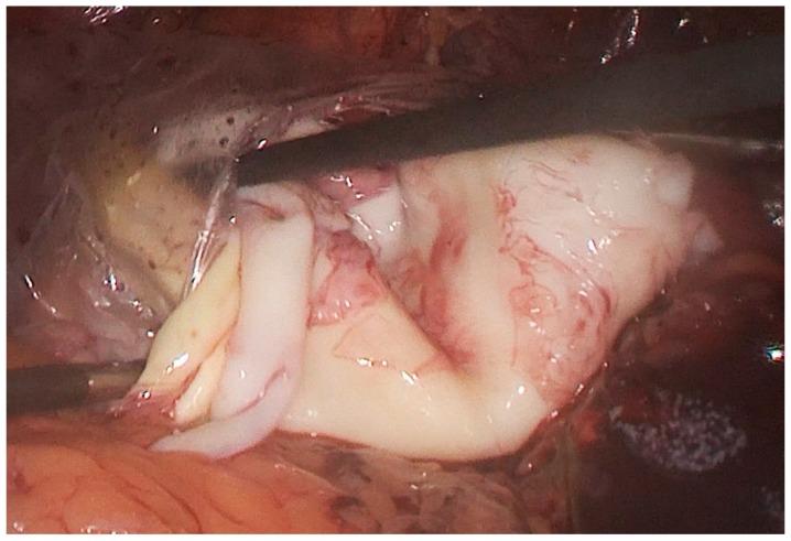 https://cdn.ncbi.nlm.nih.gov/pmc/blobs/7671/6956320/5f17c1a6c370/medicina-55-00771-g004.jpg
