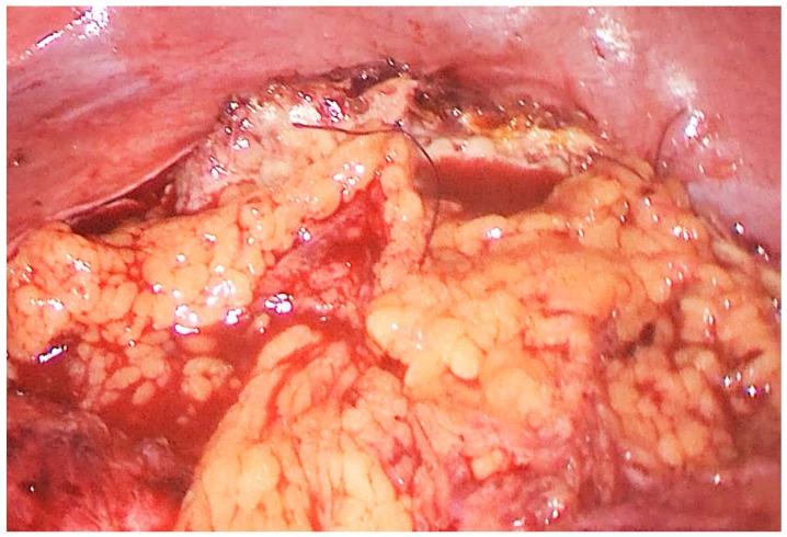 https://cdn.ncbi.nlm.nih.gov/pmc/blobs/7671/6956320/789671e51f45/medicina-55-00771-g005.jpg